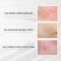Kem dưỡng ẩm và phục hồi da d Program Skin Repair Cream 45g. 