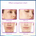 Cautery Machine Warts Removal for Warts Suitcase Portable Laser Mole Remover Electronic Laser Plasma Pen Facial Freckle Dark Warts Spot Mole Removal Machine Face Skin Care Beauty Tool Laser Warts Removal Machine. 