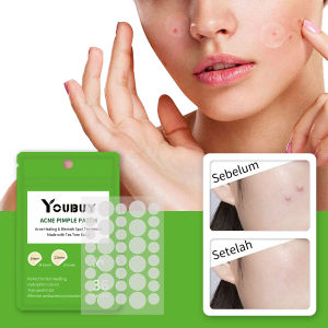 YOUBUY Spot Patch Acne Treatment Day/Night