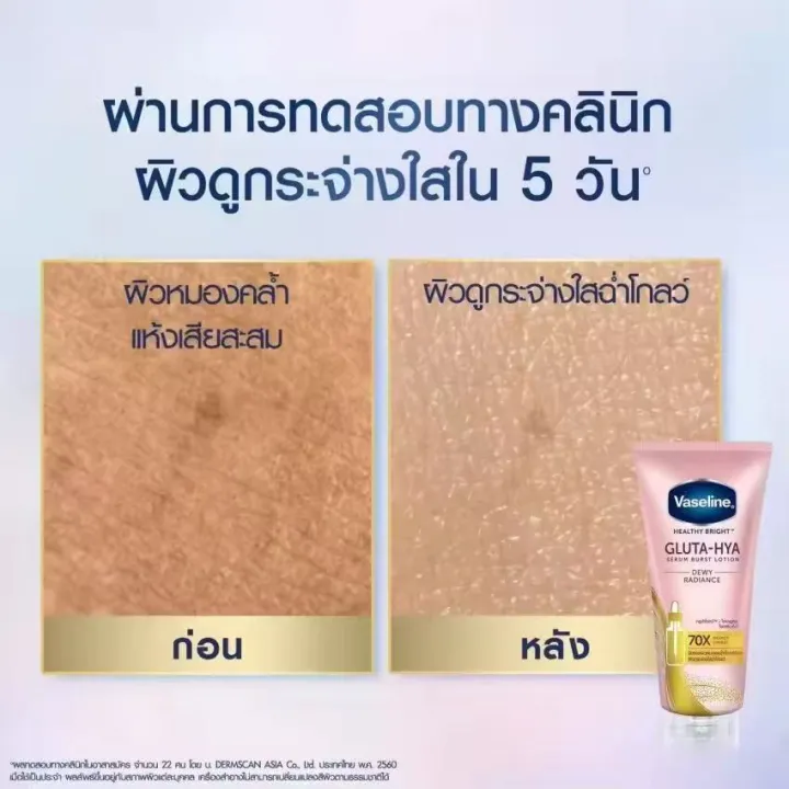 %E0%B8%A7%E0%B8%B2%E0%B8%AA%E0%B8%A5%E0%B8%B5%E0%B8%99%20%E0%B9%80%E0%B8%AE%E0%B8%A5%E0%B8%98%E0%B8%B5%20%E0%B9%84%E0%B8%9A%E0%B8%A3%E0%B8%97%E0%B9%8C%20%E0%B8%81%E0%B8%A5%E0%B8%B9%E0%B8%95%E0%B9%89%E0%B8%B2-%E0%B9%84%E0%B8%AE%E0%B8%A2%E0%B8%B2%20%E0%B9%80%E0%B8%8B%E0%B8%A3%E0%B8%B1%E0%B9%88%E0%B8%A1%20%E0%B9%80%E0%B8%9A%E0%B8%B4%E0%B8%AA%E0%B8%97%E0%B9%8C%20%E0%B9%82%E0%B8%A5%E0%B8%8A%E0%B8%B1%E0%B9%88%E0%B8%99%20300%20%E0%B8%A1%E0%B8%A5.%20%E0%B9%81%E0%B8%9E%E0%B9%87%E0%B8%84%E0%B8%84%E0%B8%B9%E0%B9%88%20Vaseline%20Healthy%20Bright%20Gluta-Hya%20Serum%20Burst%20Lotion%20300%20ml.%20Twin%20-%20Image%205