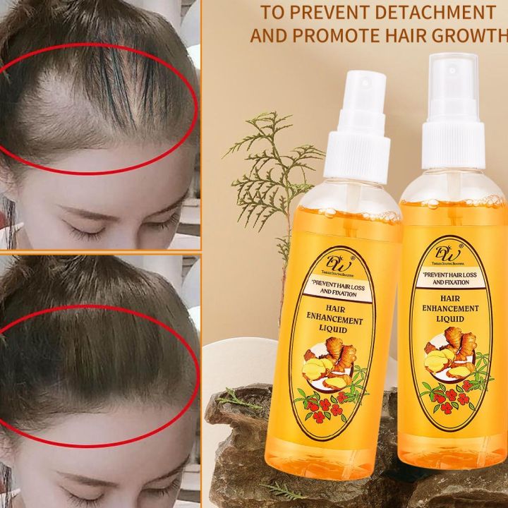 Dw Ginger Hair Growth Liquid Spray 100ml Lazada Ph 2972