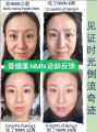 YAY SINGAPORE iHealth GENE Balance NMN Replenish Formula NAD+ Booster Contains 9000mg 99.8% Grade1USA60pcs For YOUR Health. 
