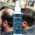 MINOXIDIL Hair Grower BEARD AND HAIR GROWTH SPRAY Nexxus Minoxidil spray regowth treatment Minoxidil. 