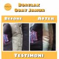 BORELAX 100ML Obat Jamur Pakaian - Penghilang Noda Cetian Cimeuting Pada Pakaian - Pembersih Noda Tinta Membandel - Pembersih Getah. 