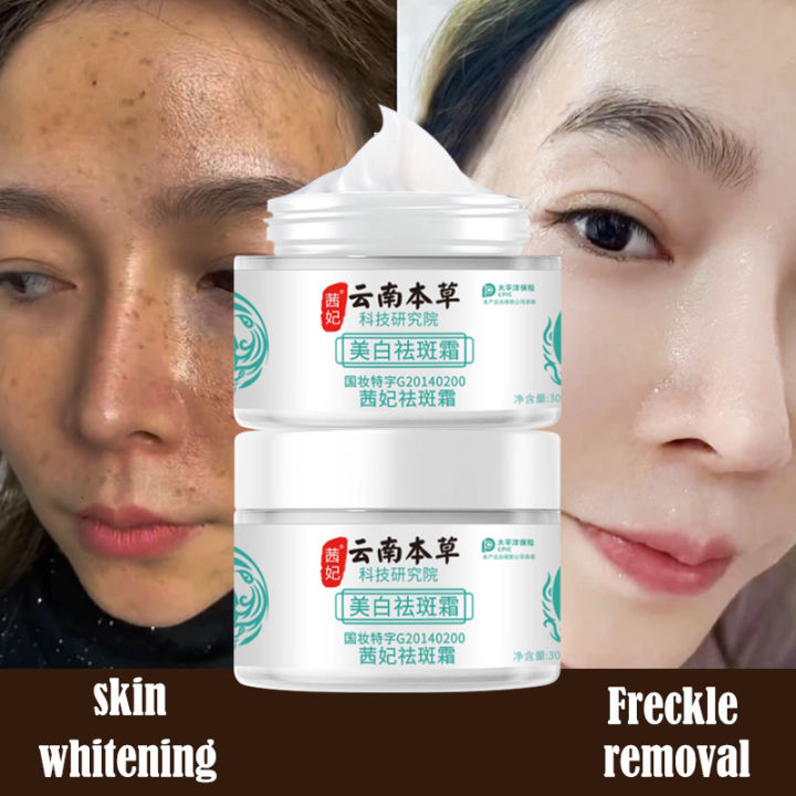 Melasma Cream Yunnan Herbal Whitening Freckle Cream Melasma Cream Original High Moisturizing 2054