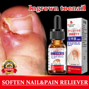 Ubat kuku rosak ingrown toenail Drops Nail Repair Serum nail fungus treatment ubat kuku cekam Nail Repair Essence Serum Relief Swelling Pain Paronychia Pain 甲沟炎嵌甲灰指甲