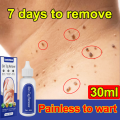 💯Wart Killer💯 Wart Removal Original 30ml, Effectively removes and heals common warts, plantar warts, flat warts, genital warts, and other viral infections on the skin. Wart Removal Cream，Fast removal, painless removal, no recovery.. 