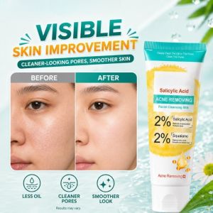 Salicylic Acid Facial Cleanser Salicylic Acid 2% Acne Treatment Clean Anti Acne Improve Facial