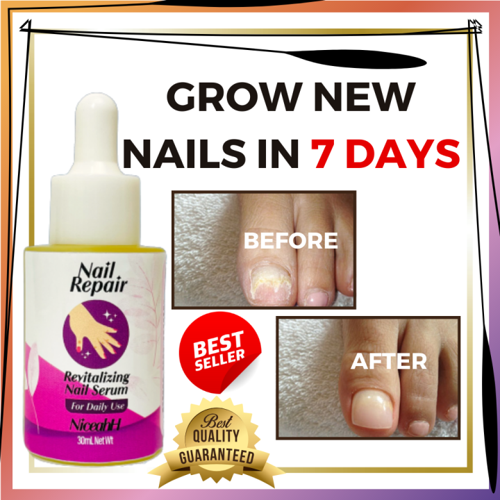 Best selling Nail repair serum Effective Nail Fungus Treatment