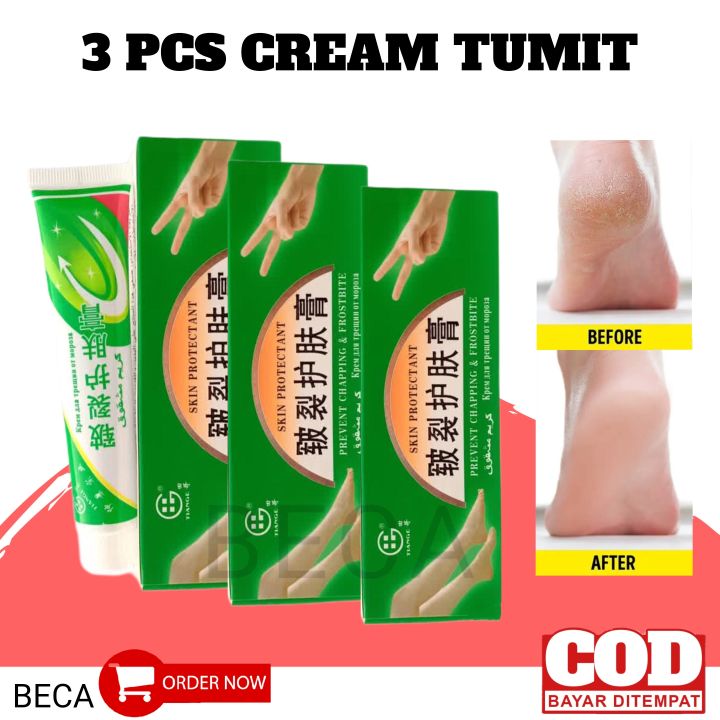 [3 PCS] Salep China Tumit Pecah Pecah Cream Kapalan - Salep Tumit ...