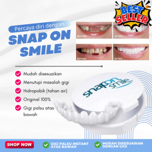 Snap On Smile Original Asli Atas Bawah Untuk Gigi Ompong Perawatan Kesehatan Gigi Palsu Renggang 1 Set