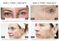 Rejuran Advanced Active Night Repair Eye Cream 15g. 