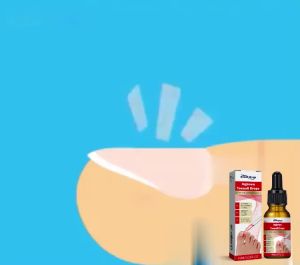 【Original Quality】Natural Extract Formula! South Moon Toenail Repair Essence Gentle Nourishment with Peace of Mind