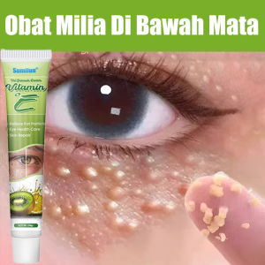 Milia Remover Eye Cream Fat Granules Removal Eye Serum Eye Milia Repair Treatment Products Wrinkle Lifting Moisturizing Anti-Puffiness Skin Care