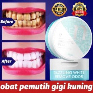 Teeth Whitening Powder-pemutih Gigi Dan Penghilang Karang Gigi-pemutih Gigi Kuning-Arang Pemutih Gigi-pemutih Gigi Kuning-pemutih Gigi-Gigi Odol Pemutih-Oral Care Teeth Whitening-pemutih Gigi Kuning Permanen Cepat Ori-bubuk Ampu Gigi
