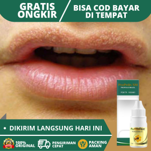 Obat Bintik Putih di Bibir Obat Penghilang Bintik Putih Di Bibir Obat Bibir Kering Obat Bibir Ada Bercak Putih Obat Pelembab Bibir Obat Bibir Berdarah Obat Bintik Putih / Hitam di Bibir Dengan Propolis SM Brazil 100% Original Alami