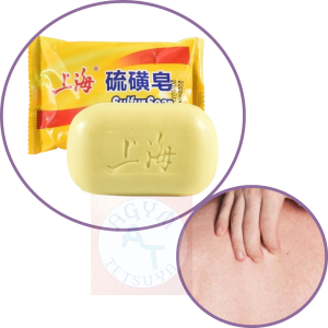 Sabun Panu Paling Cepat Hilang Seluruh Badan Soap Sulfur Belerang Obat Gatal Gatal2 Kulit Ampuh