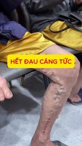 Kem Bôi Giãn Tĩnh Mạch Chân Shixendo Hỗ Trợ Giảm Mỏi Chân Nặng Chân Thư Giãn Da Chân Nhanh 30g