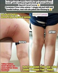PrimeSkin Lotion pemutih ketiak / bekas luka / kaki pecah-pecah / bekas gatal-gatal / UV protection