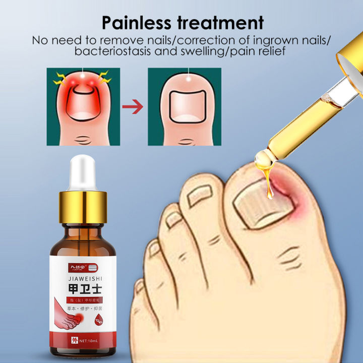 Nail toenail antibacterial essence ingrown nail groove care liquid ...