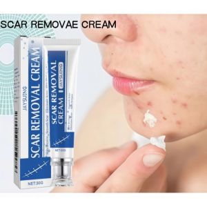 Scar Removal Cream Peklat Remover Cream For Keloid Old Scars Removal Effective Gamot Sa Peklat