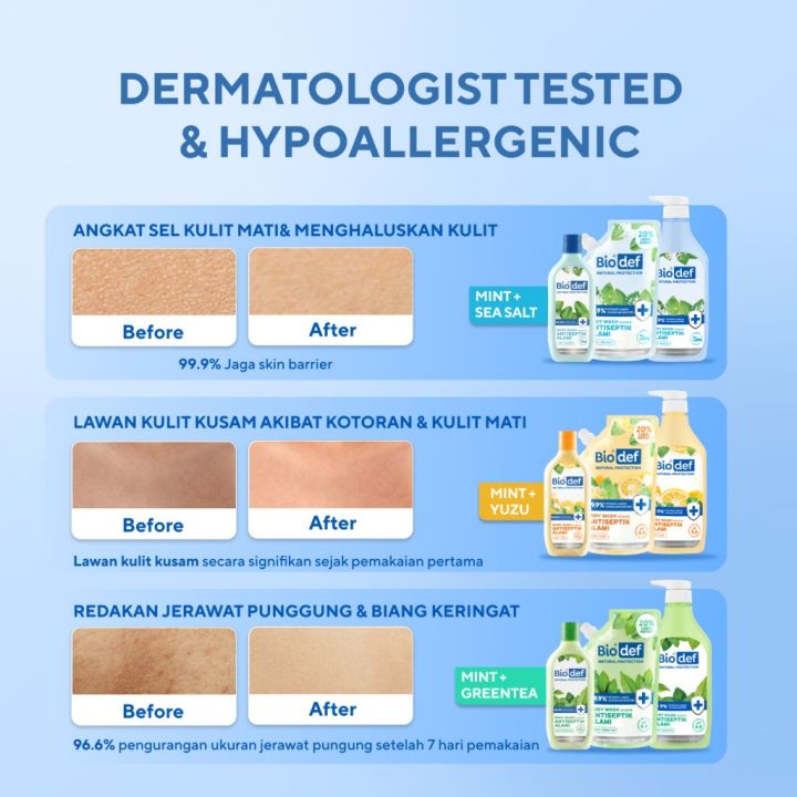 %5BAyudia's%20Favorite%5D%20Biodef%20Sabun%20Mandi%20Jaga%20Skin%20Barrier%20Whitening%20Paket%20Pump%20550ml%20dan%20Refill%20Pouch%20400ml%20Sabun%20Mandi%20Cair%20Untuk%20Meredakan%20Jerawat%20Punggung,%20Back%20Acne,%20Minyak%20Pada%20Kulit,%20Sensitif,%20dan%20Kulit%20Kering%20-%20Image%208