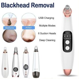 Dawaar Rechargeable Blackhead Remover Vacuum Suction Face Nose Pore Cleaner Acne Pimple Removal Facial Beauty Skin Care Tool 3W3