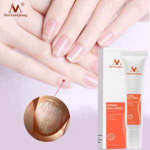 MeiYanQiong Herbal Nail Onychomycosis Paronychia Anti Fungal Nail Infection Good Result Chinese Herbal Toe Nail Fungus