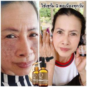เซรั่มคิว Q Double Serum คิวดับเบิ้ลเซรั่ม ลดเลือนฝ้า บำรุงผิวหน้า 30ml