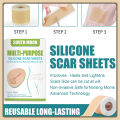 JKS（4*150cm）South Moon Silicone Scar Sheet High Efficiency Surgical Silicone Gel Tape Removal Scar Tape Treatment. 