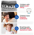 (Recommended By Doctor) Anti-Cavity Oral Spray For Kid Oral Anti-Cavity Probiotic Cleaning Spray Probiotic Oral Cleansing Spray Prevents Tooth Decay Protect Teeth Children's from 1 year old 40ml. 