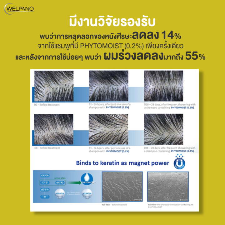 Welpano%20Supreme%20Anti-Hair%20Fall%20Biotin%20Shampoo%20And%20%20Welpano%20Silk%20Keratin%20&%20Biotin%20Hair%20Vital%20Boost%20Conditioner%20and%20Treatment%20-%20Image%207