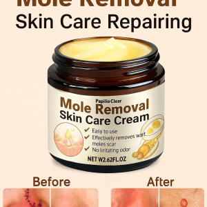 Repair Paste Unique Efficacy High-end Positioning Lighten Skin Moles Sensitive Skin Safety