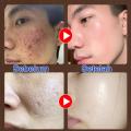 Kem làm trắng và dưỡng ẩm nam Kem khuôn mặt lười biếng Kem BB nam Sản phẩm làm da sáng và làm vững Kem làm da sáng Nhẹ nhàng và không gây kích thích Chăm sóc cá nhân 120g. 