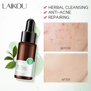 LAIKOU Anti Acne Serum Australia Tea Tree Essence Anti-Inflammatary Oil Control 17ml