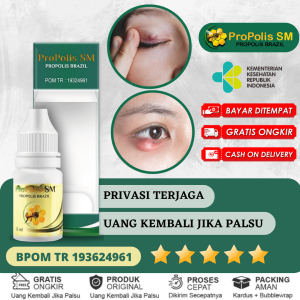 Obat Mata Kalazion - Benjolan di Kelopak Mata - Mata Bintitan - Mata Bengkak - Penghilang Benjolan di Kelopak Mata - Pengempis Bengkak di Kelopak Mata - Mata Bengkak Alami Propolis SM Brazilian 100% Asli