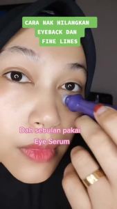 BREYLEE Eye Serum Eyebag Remover Serum Dark Circles Fading Essence Moisturizing Anti-wrinkle Eye Cream Eye care VC Whitening Retinol Anti-Aging HA