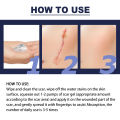 JAYSUING Advanced Silicone Scar Gel Recovery Scar Cream Scar Gel Silicone Surgical Scars C-Section Stretch Marks Acne Pox Prints Burn Repair Facial Care Gel Acne Pimples Treatment Smoothening Face Skin Care Beauty. 