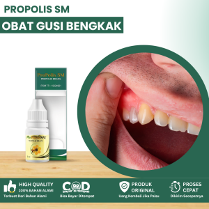 Obat Gusi Bengkak Gusi Sakit Obat Radang Gusi Gingivitis Obat Akar Gusi Memerah Benjolan Di Gusi Infeksi Gusi Obat Gusi Turun Ke Bawah Obat Gusi Bernanah Obat Gusi Turun Karena Behel Gigi Obat Sakit Gusi Anak Dan Dewasa Dengan Propolis SM