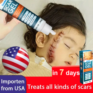 15 days Scar removal gel Scar remover for old scar on leg Repair Skin Care Stretch marks Scars remover for old scars Burn Scar Remover for Body And Face Scar Gel Acne Scar Treatment Skin Care cream 30g