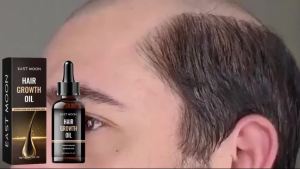 East Moon Thick Hair Serum Nourishes Hair Follicles Moisturizes Nourishes Hair Roots Strengthens and Thickens Hair.