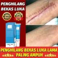 Penghilang Bekas Luka -Menghilangkan bekas luka lama di kaki-Menghilangkan bekas luka hitam-Menghilangkan bekas luka di wajah-Menghilangkan bekas luka lama-Cream penghilang bekas luka permanen-Cream penghilang bekas luka koreng hitam. 