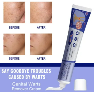 Wart Removal Ointment Mole Remover Warts Remover Original Cream Skin Tags Removal Gel Face Body Care Mole Remover Wart Removal Body Warts Treatment Skin Tags Mole Remover Cream 20g