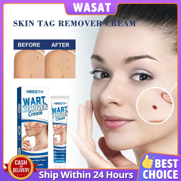 Warts Remover Original Cream Wart Removal Ointment Skin Tags Mole ...