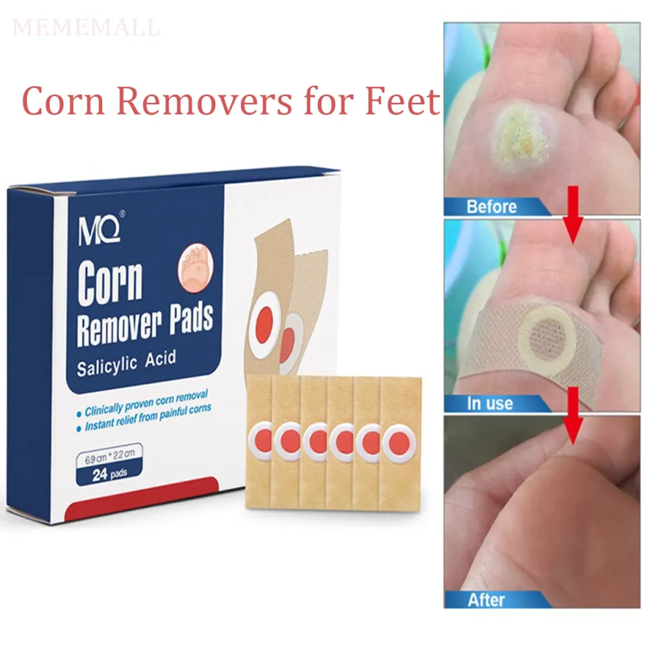 Nice Feet Corn Remover Corn Removers for Feet Toes 24 Pack Corn Removal  Cream Patches