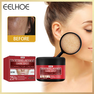 Eelhoe Blemish Remover Cream Dark Spot Remove Correction Cream Pigment Melanin Corrector Skin Lightening Moisturizing Face Care Nicotinamide Dark Spots Whitening Cream Brightening Melanin Melasma Blemishes Pigmentation Acne Marks Face Whitening Cream