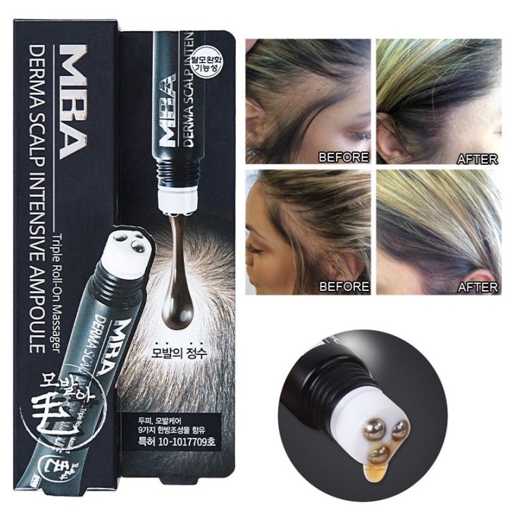 MBA Derma Scalp Intensive Ampoule Triple Roll-On Massager 20ml ...