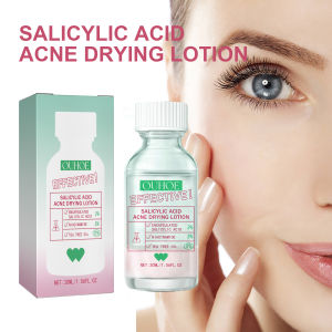 OUHOE Salicylic Acid Acne Lotion Gentle care for acne-prone skin refines pores moisturizes facial skin