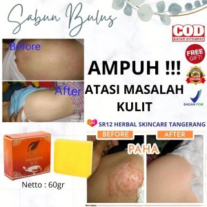 Sabun Bulus SR12 Original: Solusi Gatal dan Pencerah Wajah & Tubuh