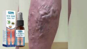 Varicose Vein Soothing Spray Leg Pain Relief Spray Natural Herbal Non Irritating Gentle Skin Care